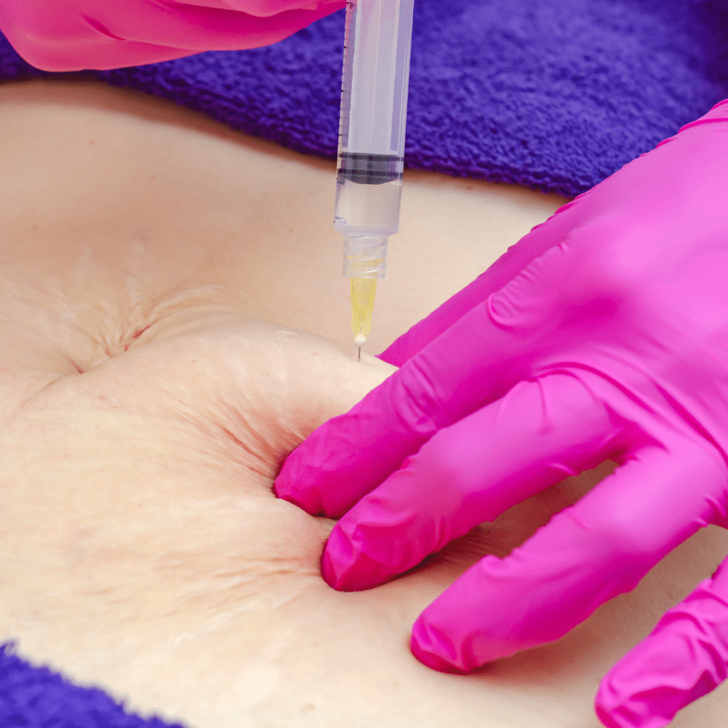 Mesotherapy Fat Burn (Fat Dissolving) - Body Treatments - Dubai - Swan ...