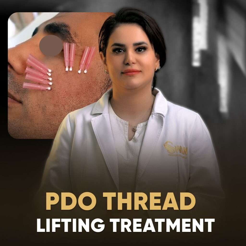 PDO Thread Lifting Treatment In Dubai - Collagen-stimulating Skin ...