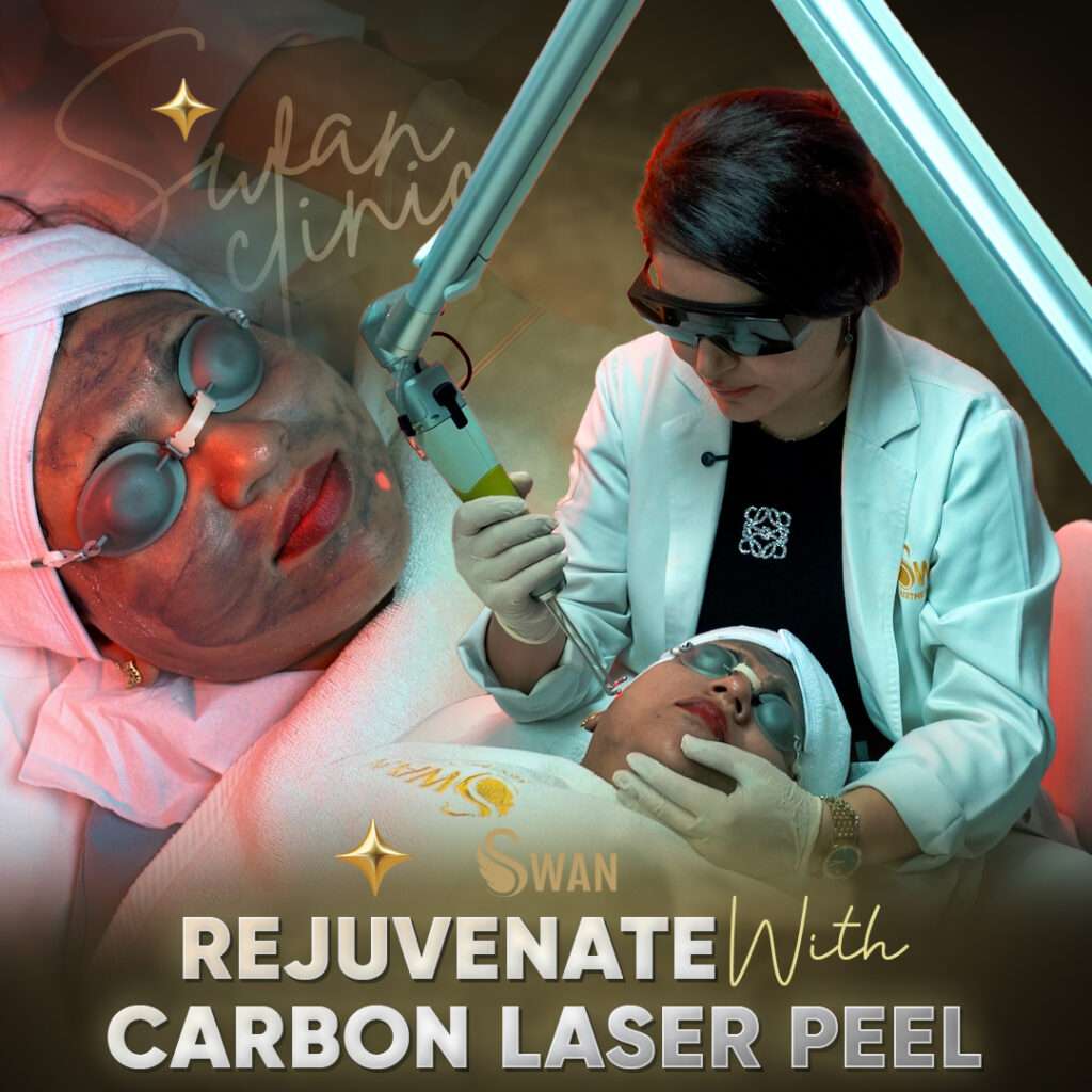 The Carbon Laser Peel and Why So Many People in Dubai Keep Coming Back ...